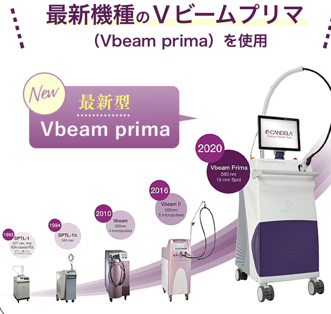 vビーム プリマについて | セタクリニック黒川